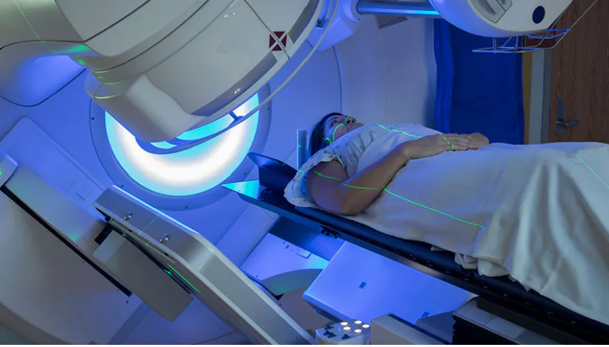 Beperkte acute toxiciteit en acceptabele 90-dagen mortaliteit na SBRT voor stadium I-NSCLC<i class='restricted-content fa fa-lock'></i>