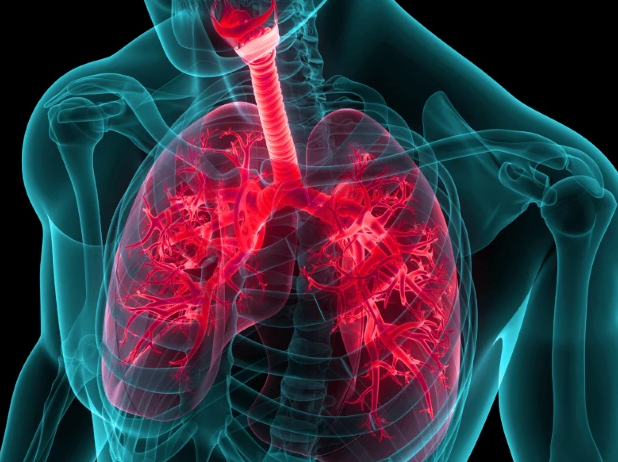 Resistentie voor immuuncheckpointremmers overwinnen bij gevorderd NSCLC met Ipilimumab + SBRT<i class='restricted-content fa fa-lock'></i>