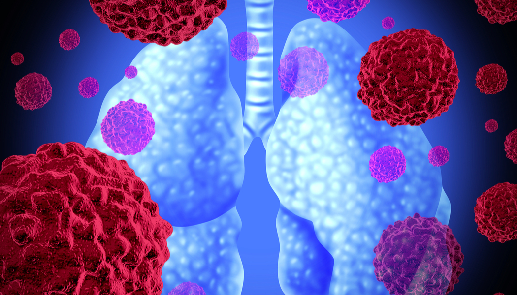Combinatie  encorafenib-binimetinib voor BRAF-V600E-gemuteerd NSCLC voldoet aan PASKWIL-criteria<i class='restricted-content fa fa-lock'></i>